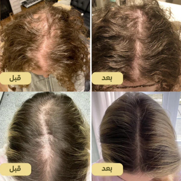 ⁦عرض فرشاة التيكتوك المشهورة + زيت الشعر الطبيعي EELHOE⁩ - الصورة ⁦4⁩